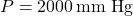 P = 2000 \, \text{mm Hg}